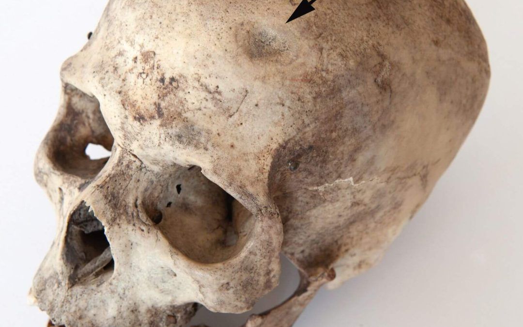 Diacronía de la violencia en la sociedad prehispánica de Gran Canaria