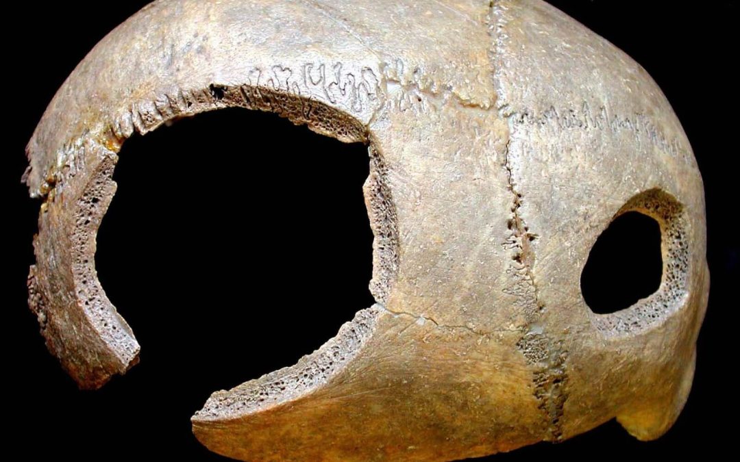 De espíritus malignos y supersticiones a la locura. La evolución de las trepanaciones